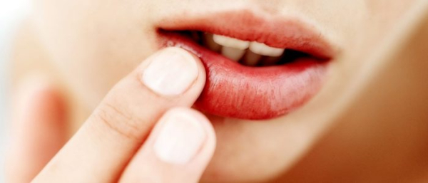 Бородавки на губах
