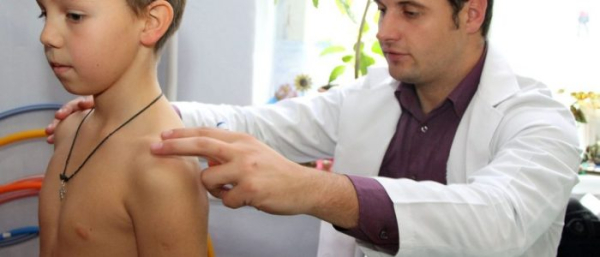 Бородавка у ребенка