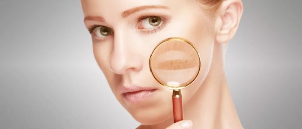 Пигментное пятно увеличивающееся в размере