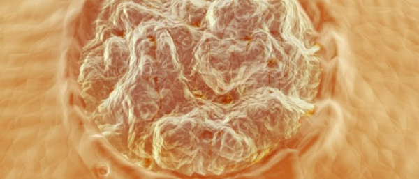 Что внутри у бородавок?