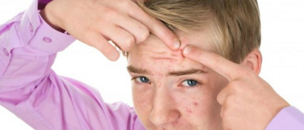 Средства от прыщей для подростков