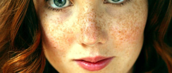 Пигментное пятно на лице после беременности