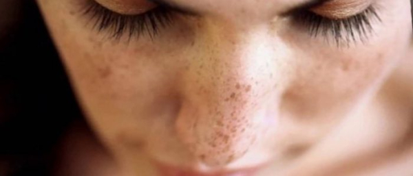 Пигментные пятна от вросших волос