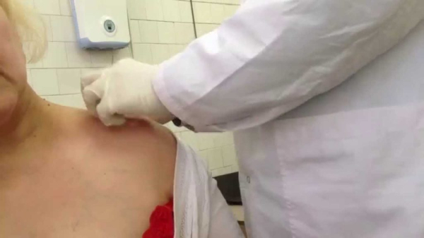 Пигментная пурпура Шамберга