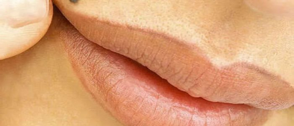 Голубая родинка