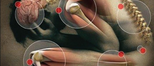 Фиброма мягких тканей