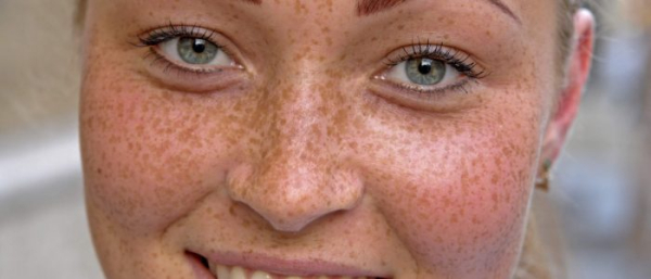 Avene от пигментных пятен