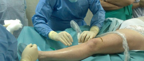 Может ли гигрома лопнуть?