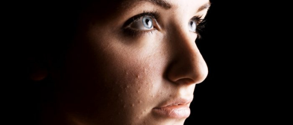 Белый маленький жировик