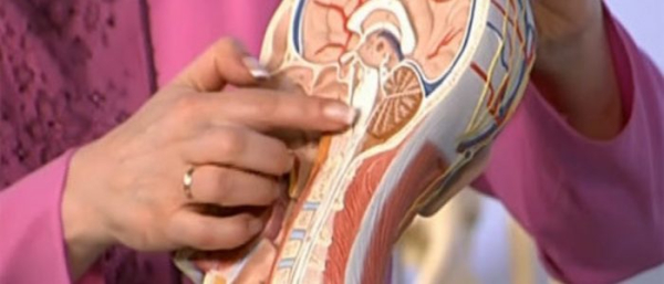 Липома в головном мозге