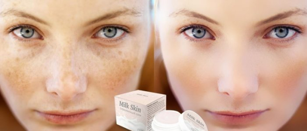 Милк Скин от пигментных пятен