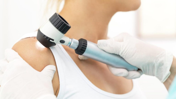 Как диагностировать меланому?