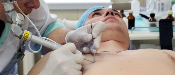 Меланому вырезают или нет?