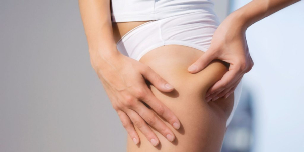 Жировик на попе