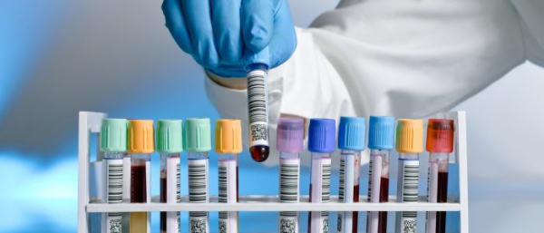 Анализы на вирус папилломы человека