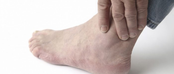 Нарост на суставе