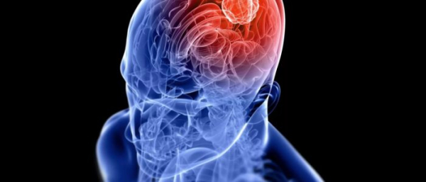 Липома в головном мозге