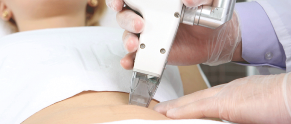 Наросты на коже