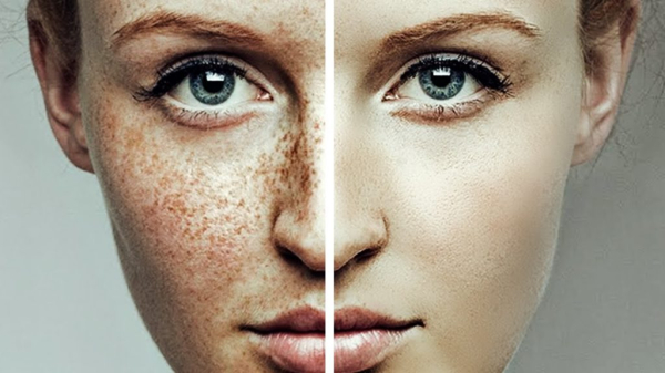 Маска от пигментных пятен и веснушек