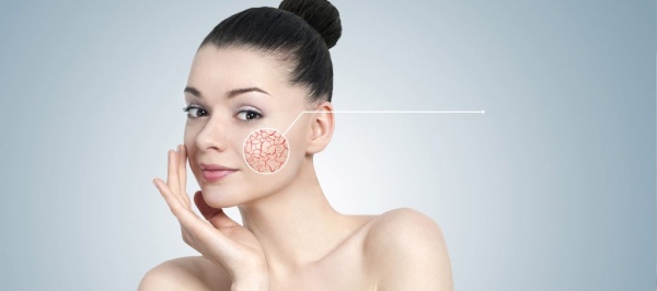 Гемангиома лица