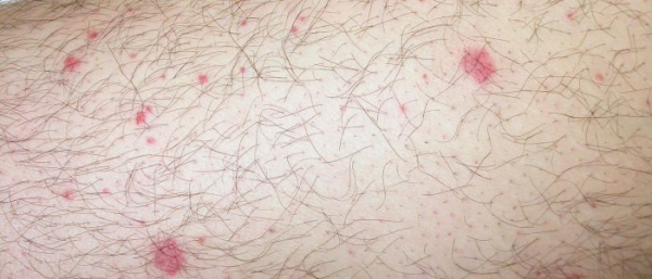 Красная точка