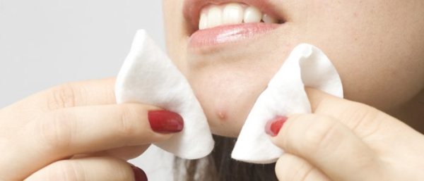 Можно ли выдавливать жировики?