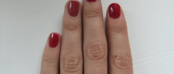 Родинка на пальце