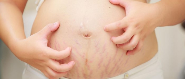 Жировик при беременности