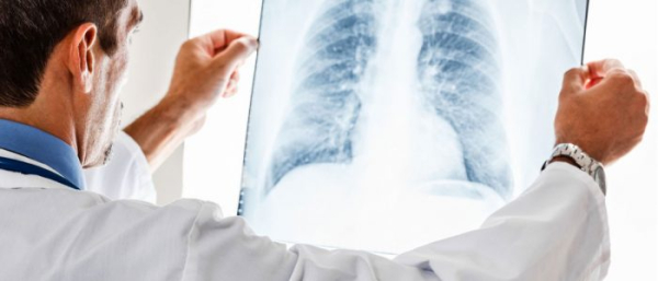 Гемангиома легкого