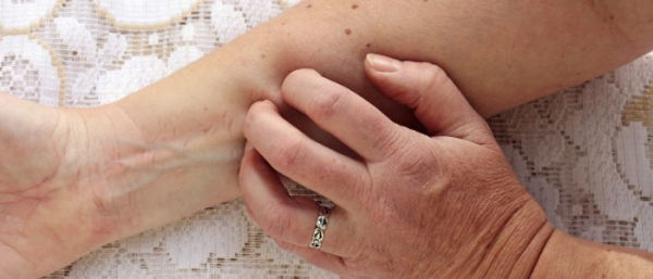 Зуд на родинке