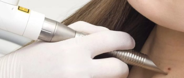 Методы удаления новообразований