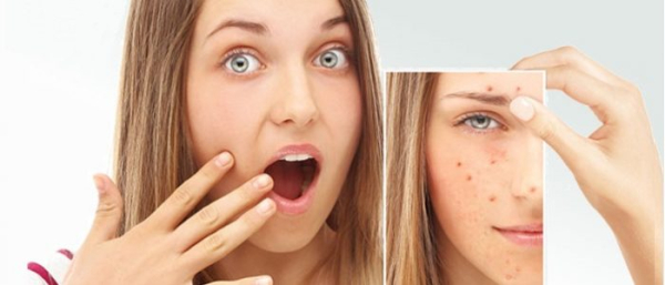 Постакне и Элос