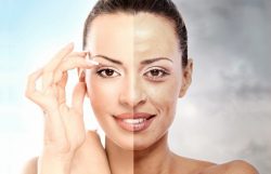 Делекс Акне &ndash; гель от угрей