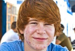 Пропеллер &ndash; салициловая болтушка от прыщей