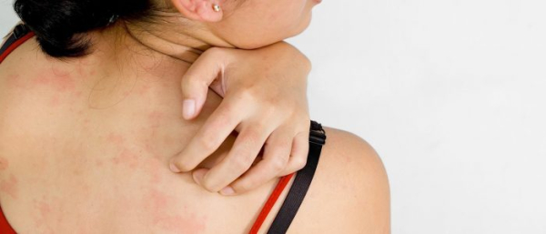 Фурункул на спине